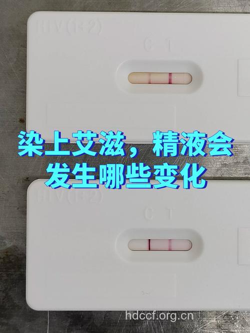 清洁精子 艾滋病后继无人