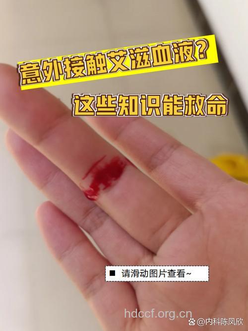 如何处理艾滋病感染者血液