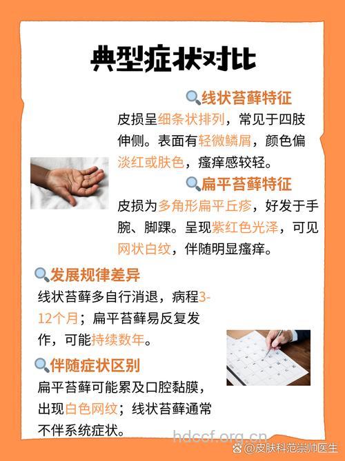 如何区别线形苔藓和扁平苔藓