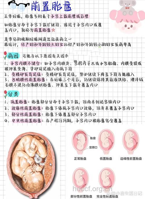 分娩期间前置胎盘怎么办