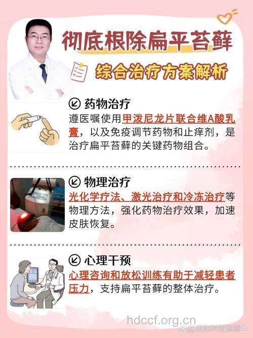 有哪些预防扁平苔藓疾病的方法