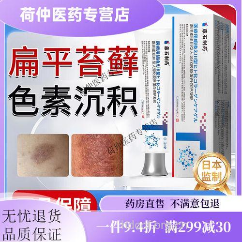 如何更好应对色素扁平苔藓呢