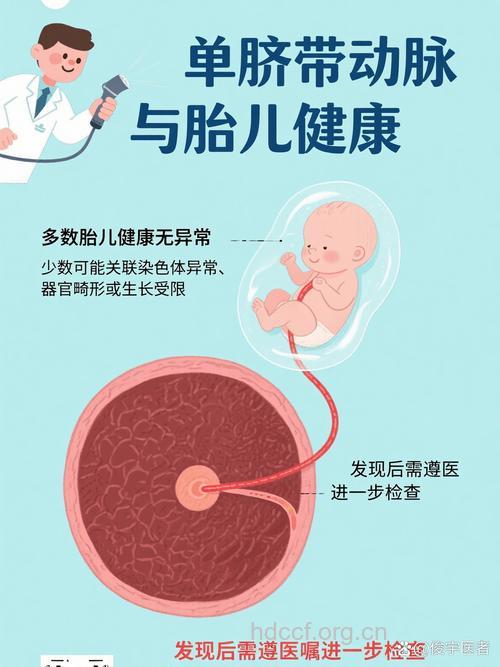 单脐动脉对胎儿有影响吗