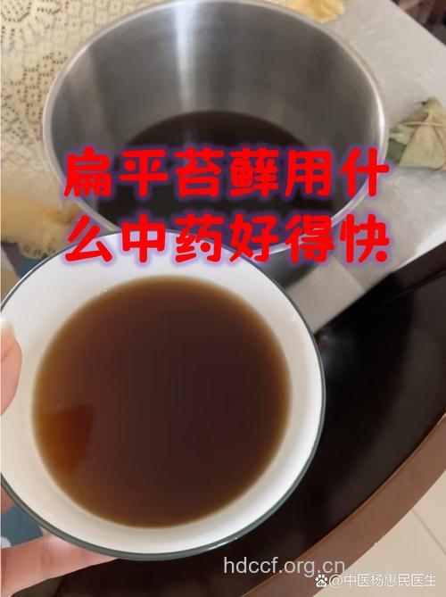 清火药能好治疗扁平苔藓吗