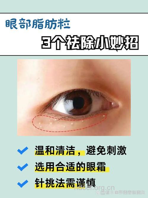 早晚眼霜用不同质地可有效预防眼周脂肪粒