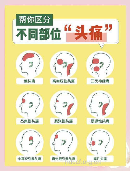 有哪些类型的偏头痛