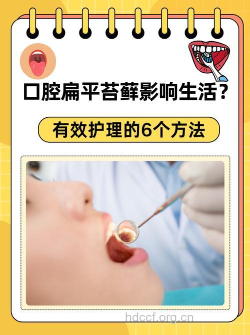 口腔扁平苔藓护理有哪些注意