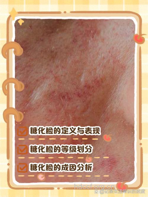 皮肤粗糙 都是糖化惹的祸？