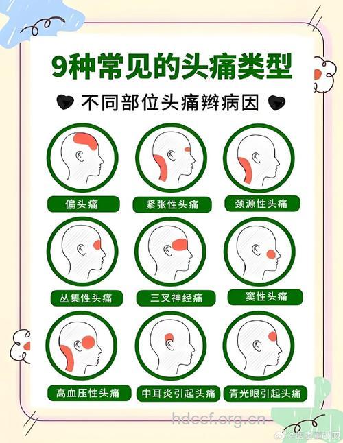 专家告诉你偏头痛的症状表现