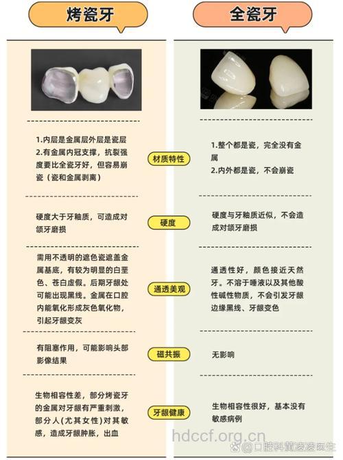 影响烤瓷牙寿命的五大因素