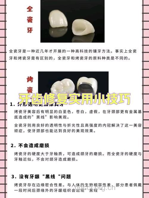我们要如何来选择好的烤瓷牙