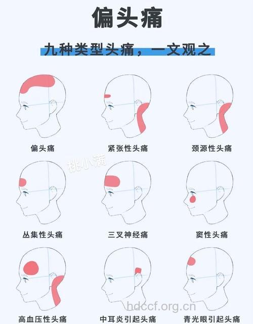 偏头痛有哪些类型呢
