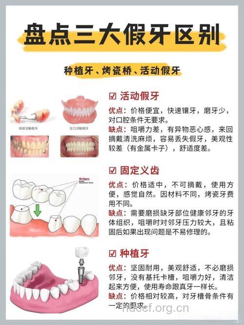 镶牙前后的注意事项有哪些
