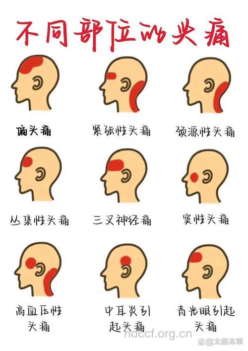 偏头痛的常见症状表现有哪些