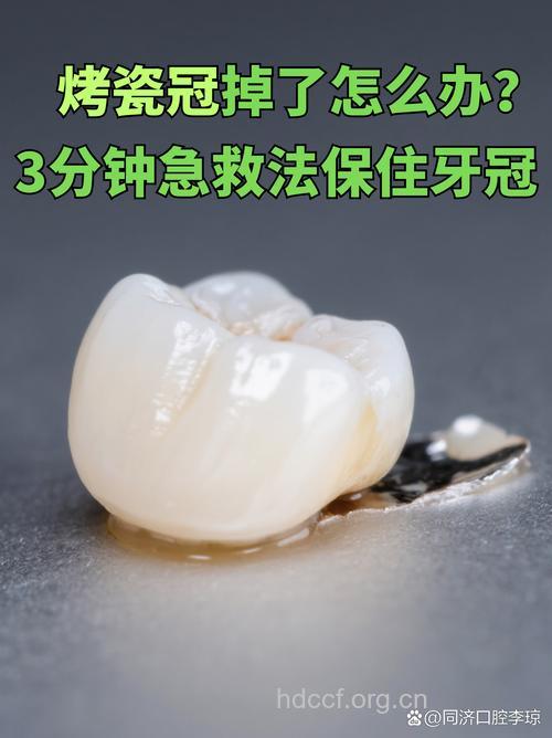 烤瓷牙掉了该怎么办