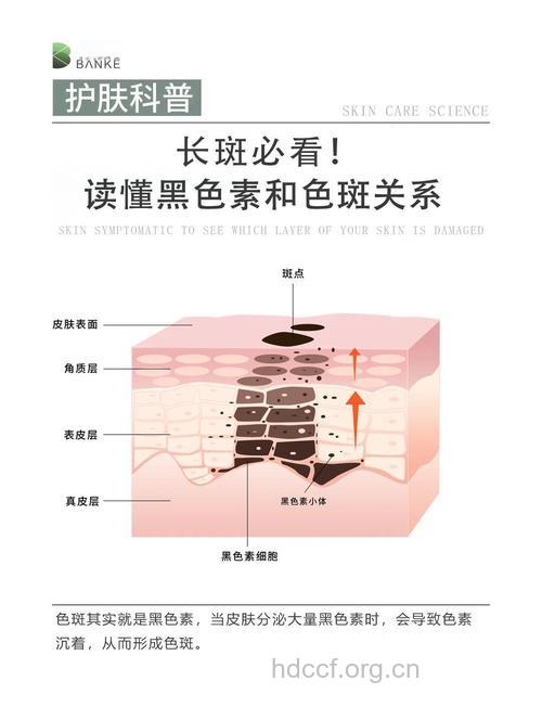 祛斑需要先认识什么是黑色素