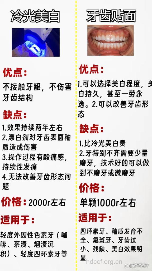 哪些因素影响牙齿美白价格