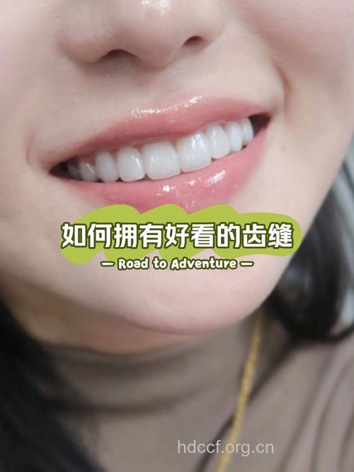 牙齿变身之美牙格调