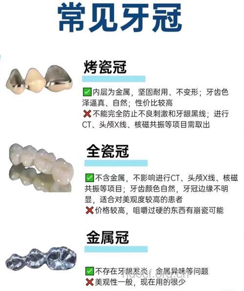 烤瓷牙必需知道的知识