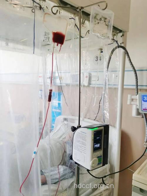我国造血干细胞移植治疗1型糖尿病获成功
