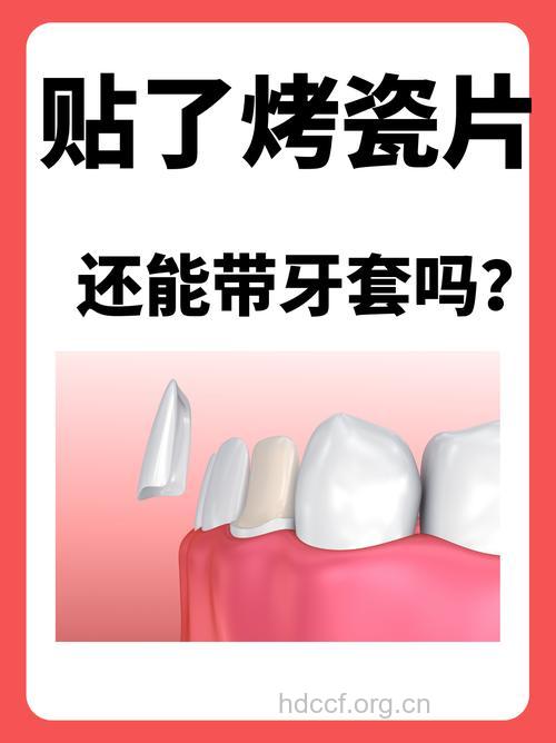 烤瓷牙帮你拯救牙齿