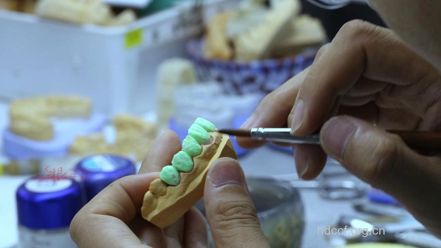 烤瓷技术的完整操作步骤参考
