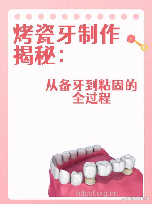 怎样才可做烤瓷牙?
