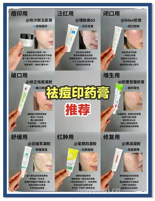 去痘印法 MM的痘痘克星