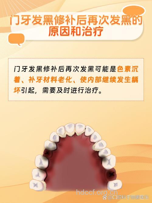 烤瓷牙修复后牙龈发黑是什么原因