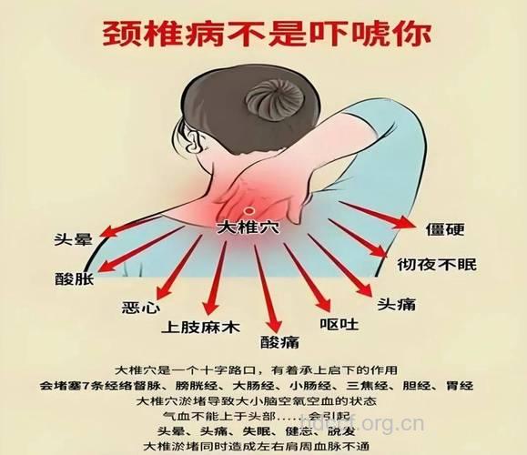 这些症状当心与颈椎病结缘