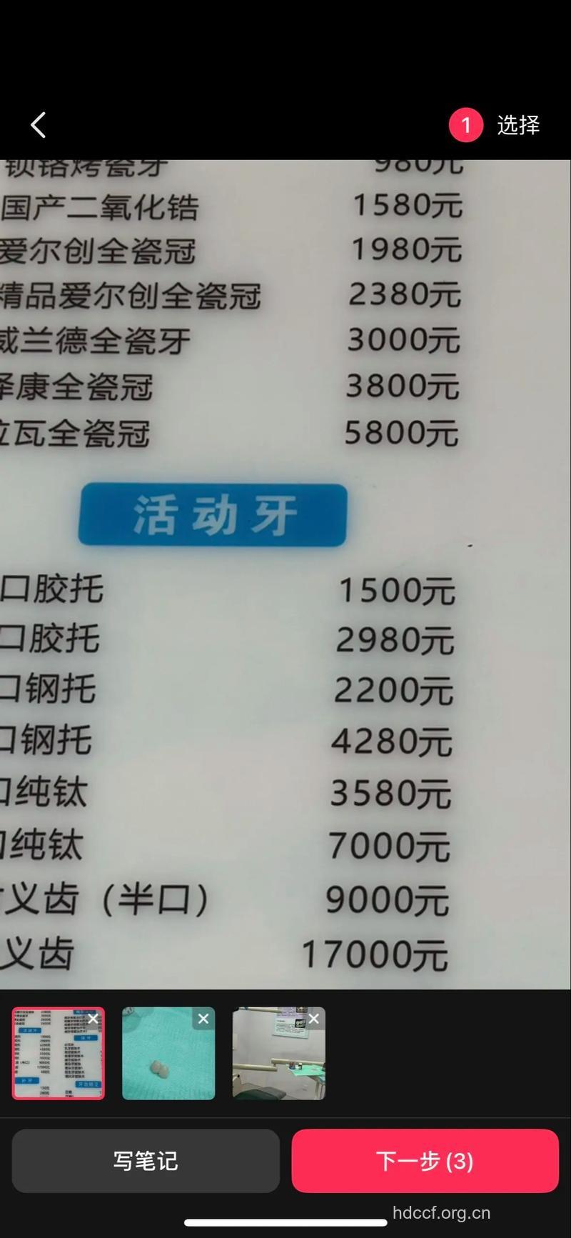 各类烤瓷牙的价格是多少