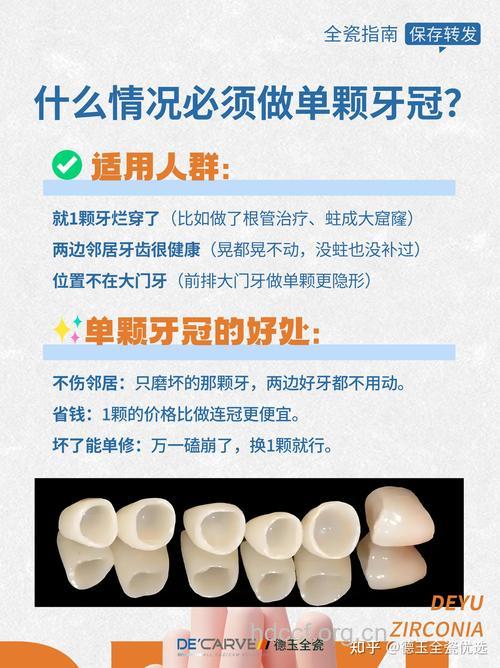 选烤瓷牙 材料有讲究