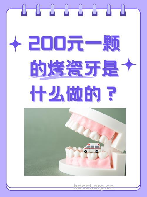 修复烤瓷牙,有哪些需要了解的呢?