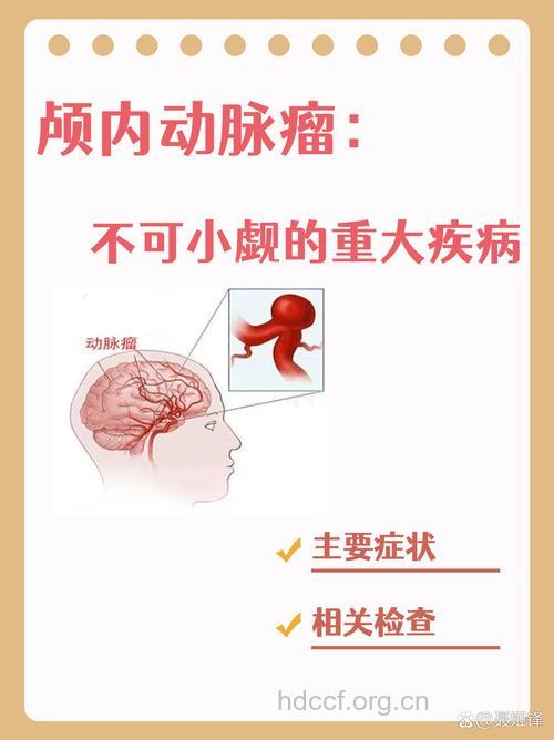 交替性头痛需警惕动脉瘤