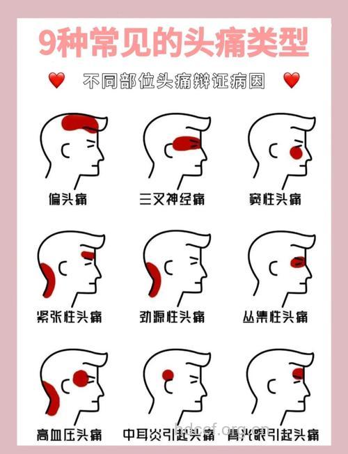 两种特殊类型的头痛