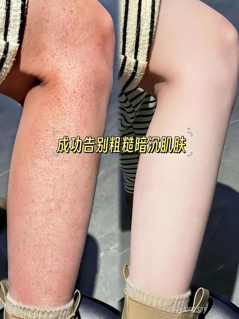 夏日出游前 重焕弹性肌肤