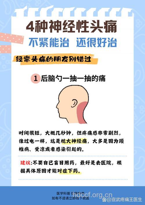 关于偏头痛的新发现