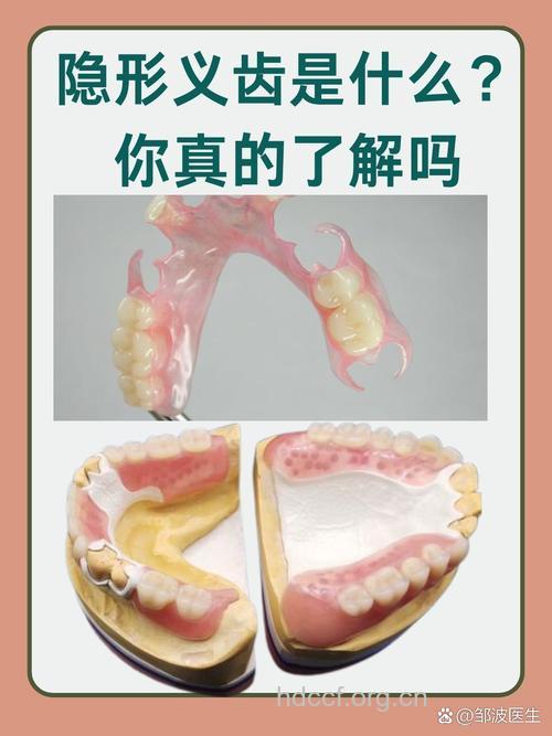 假牙护理 假牙最怕的四件事