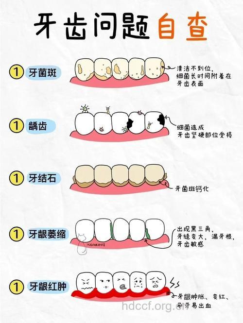 一定要注意的3个牙齿问题