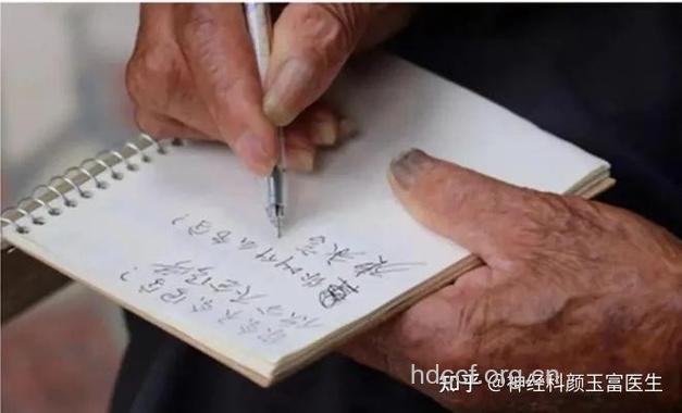 笔迹小可能是早期帕金森