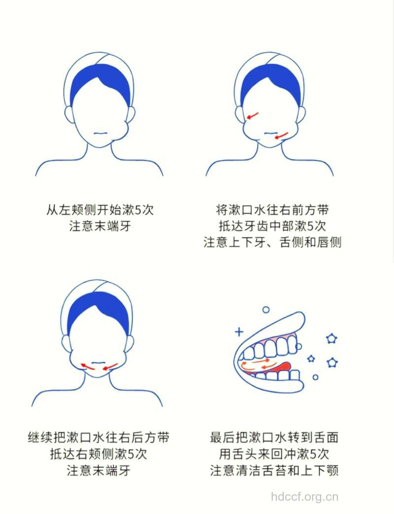漱口水怎么用