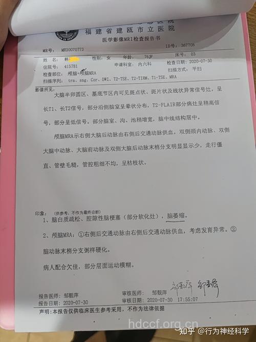 阿尔茨海默病诊断