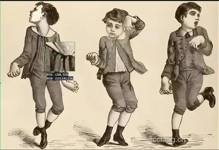 亨廷顿病有哪些症状？