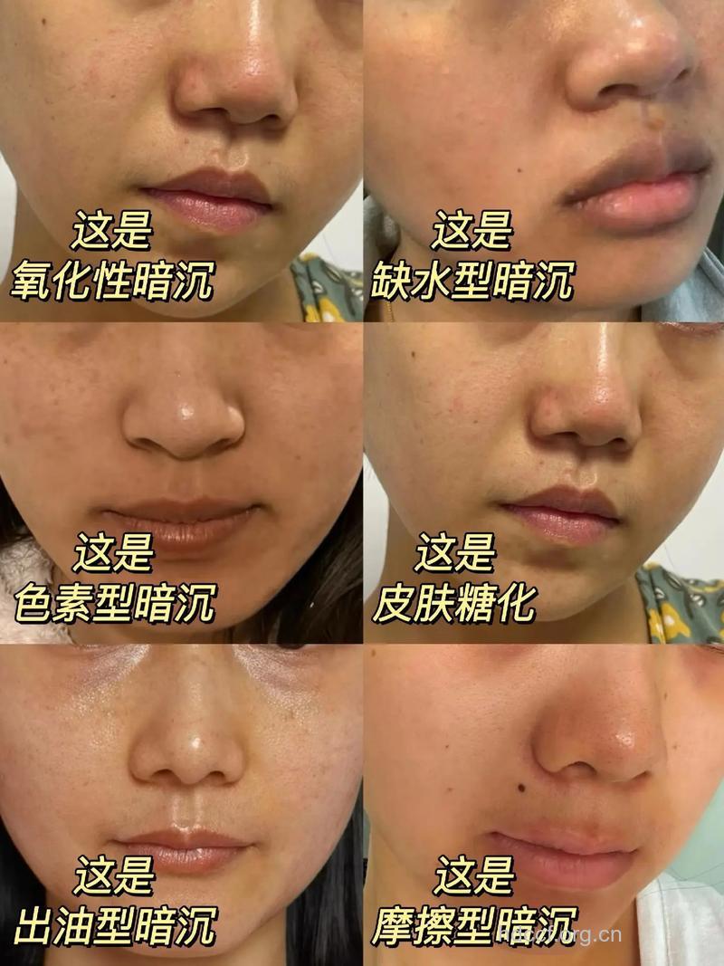 小暗沉快滚开肌肤瞬间亮白