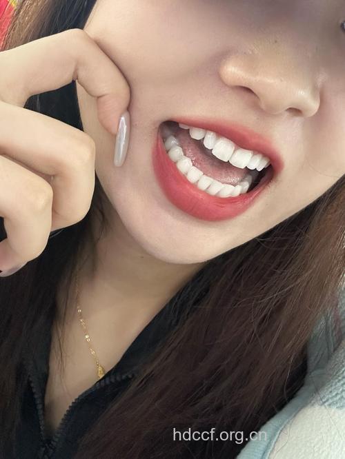 刷出来的一口“好牙”