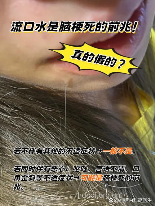 睡觉经常流口水别忽视 脑血栓的7个前兆