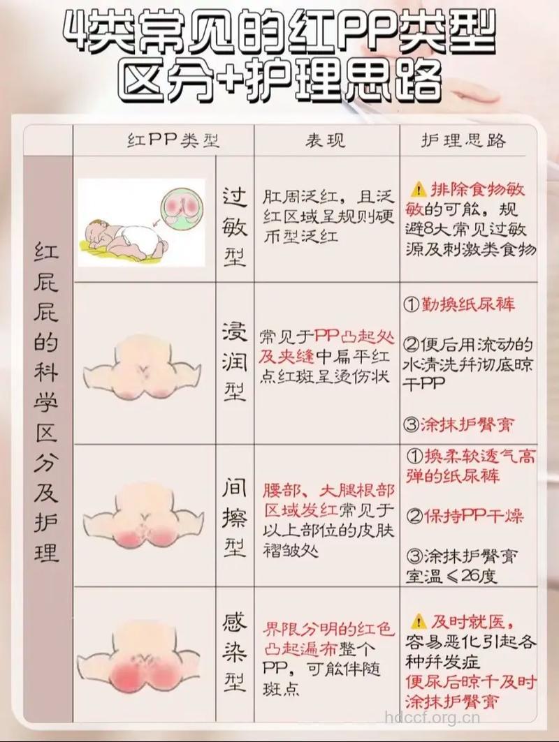 怎么保护宝宝的小pp