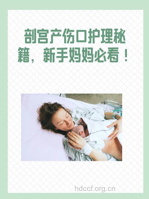 剖腹产新生儿护理方法