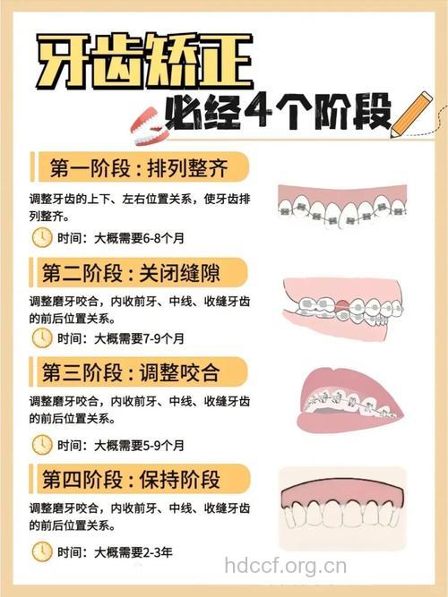 牙齿矫正有哪些保健方法