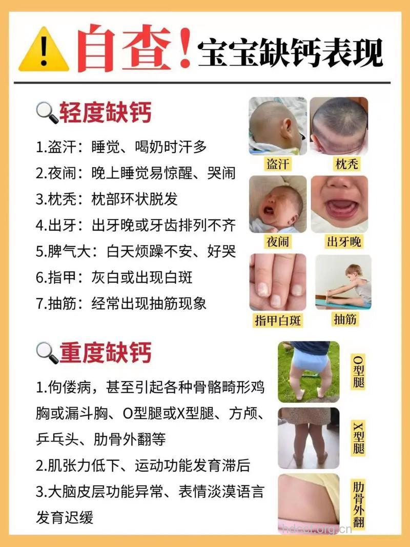 有哪些帮宝宝补钙方法